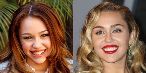 10 Celebrities with Veneers - Celebrities Who Had Major 