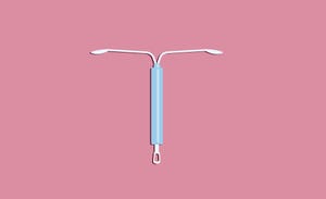 Woman’s Iud Moves To Abdomen 11 Years Later - Signs To Watch For