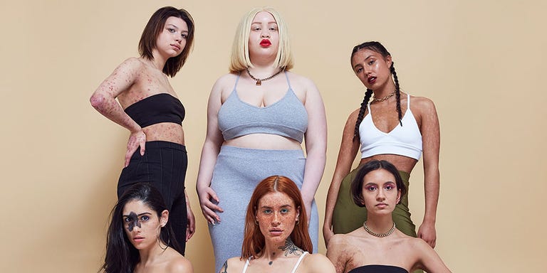 Missguided In Your Own Skin Ad Campaign Why Missguided Want You To Embrace Your Flaws