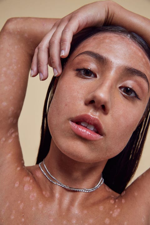 Missguided in your own skin campaign