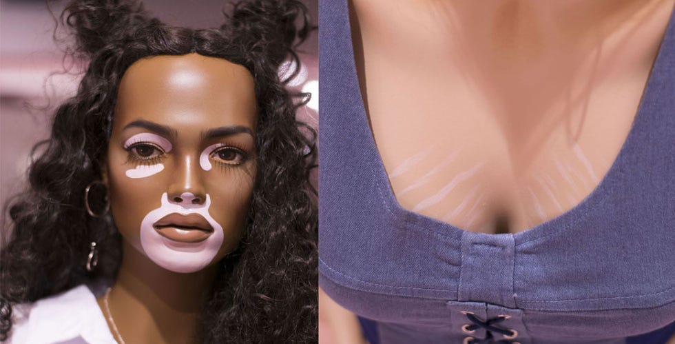 Missguideds New Mannequins Come With Stretch Marks And Vitiligo