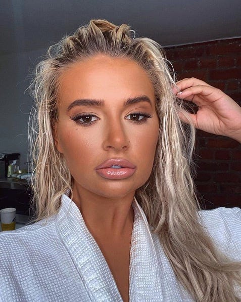 Molly-Mae Hague Reveals She Has Had Her Face Filler Dissolved