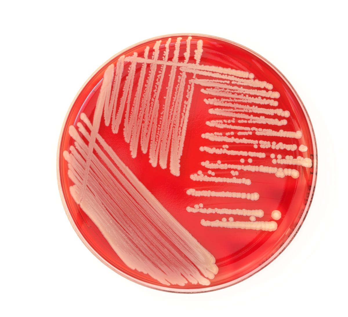 Methicillin Resistant Staphylococcus Aureus Mrsa Infection