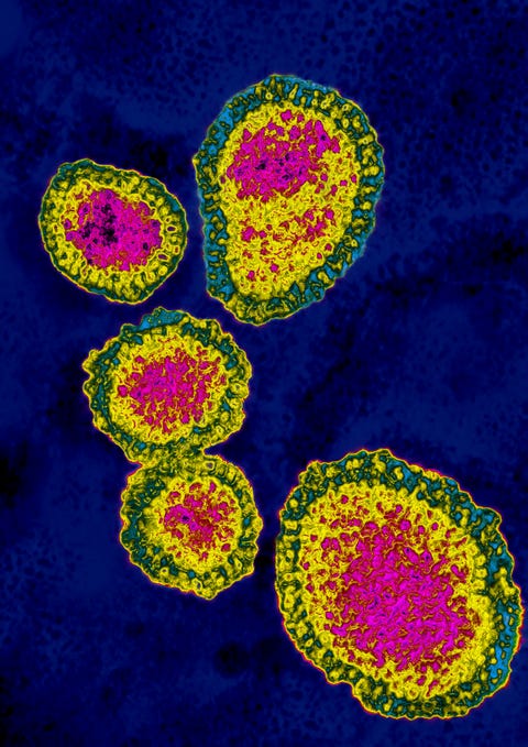 What is the G4 Virus? The New Swine Flu with “Pandemic Potential”