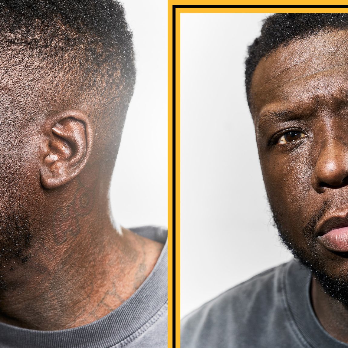 Nate Robinson's Fight for His Life