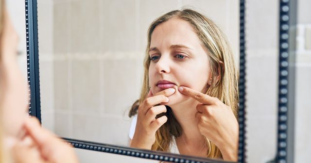 顎や口まわり フェイスラインのニキビはなぜ繰り返す 正しいスキンケアと対策を皮膚科医が解説