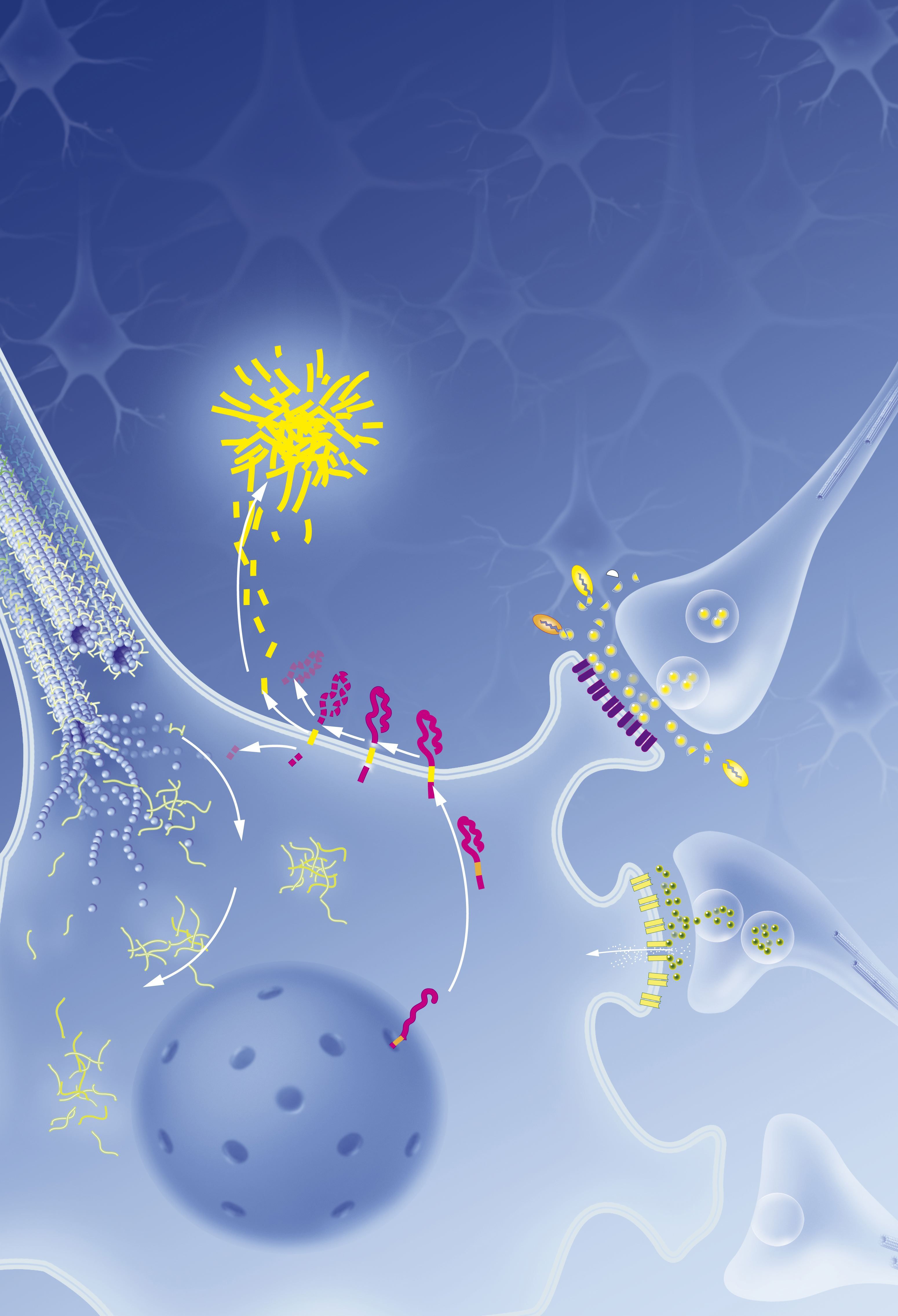 Alzheimer'S: The Inheritance Factor - 180scvt