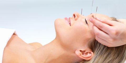 acupuncture for acne