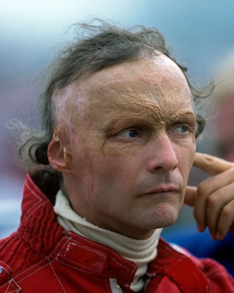 Niki Lauda, Auto-Racing Legend, Dies at 70 - Obituary, Life Story