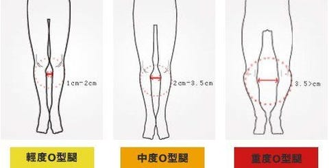 物理治療師教妳每天十分鐘 矯正o型腿 拉筋 同時瘦小腿肌肉 物理治療師教妳每天十分鐘 矯正o型腿 拉筋 同時瘦小腿肌肉