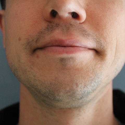 Why Can't I Grow a Mustache? Facial Hair Tips for Men