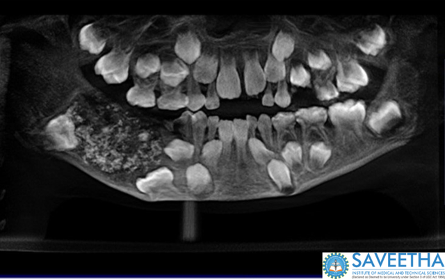 obrazowanie medyczne, RTG, Radiologia, radiografia, szczęka, usta, Martwa natura Fotografia, Medycyna, organizm, serwis, 