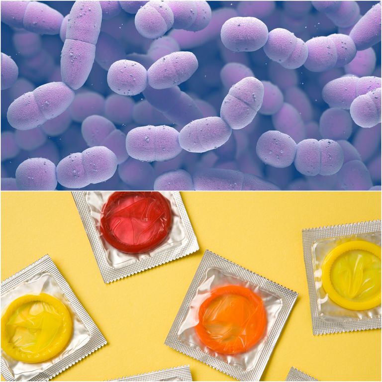 condoms to prevent superbug STI