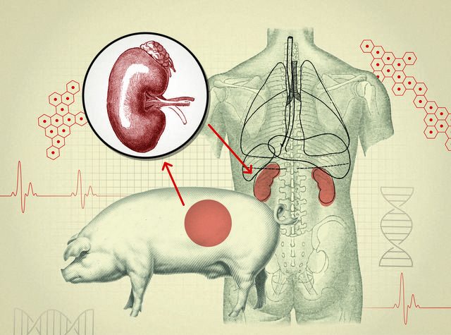 kidneys, human kidneys, pig kidneys