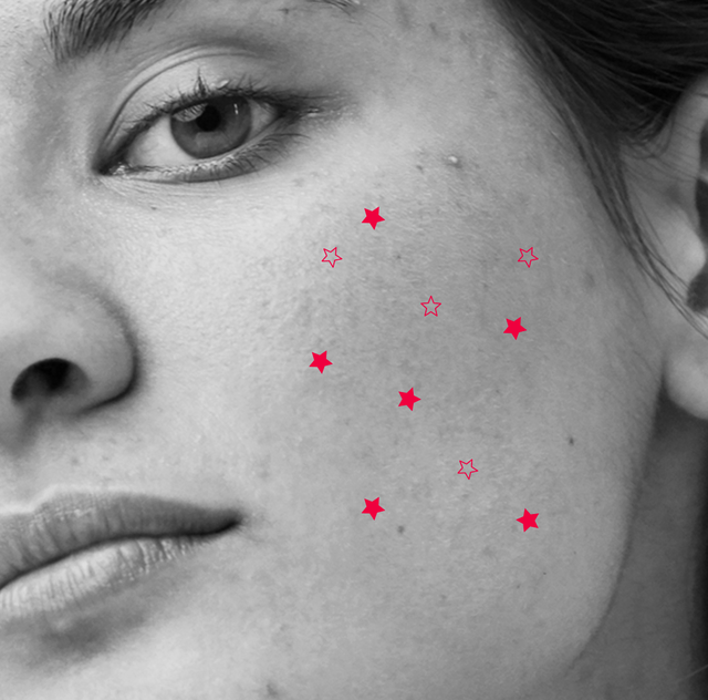 black and white photo of woman with pink star emojis on her face