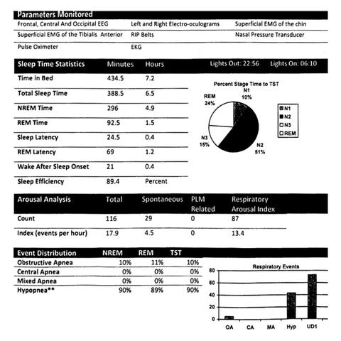 sleep tracking