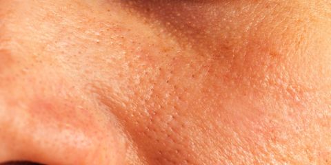 6 Habits That Are Clogging Your Pores | Prevention
