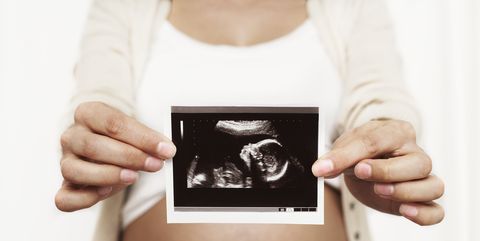 Kuvahaun tulos haulle ultrasound picture