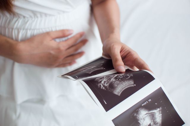 a pregnant woman is holding an ultrasound scan result