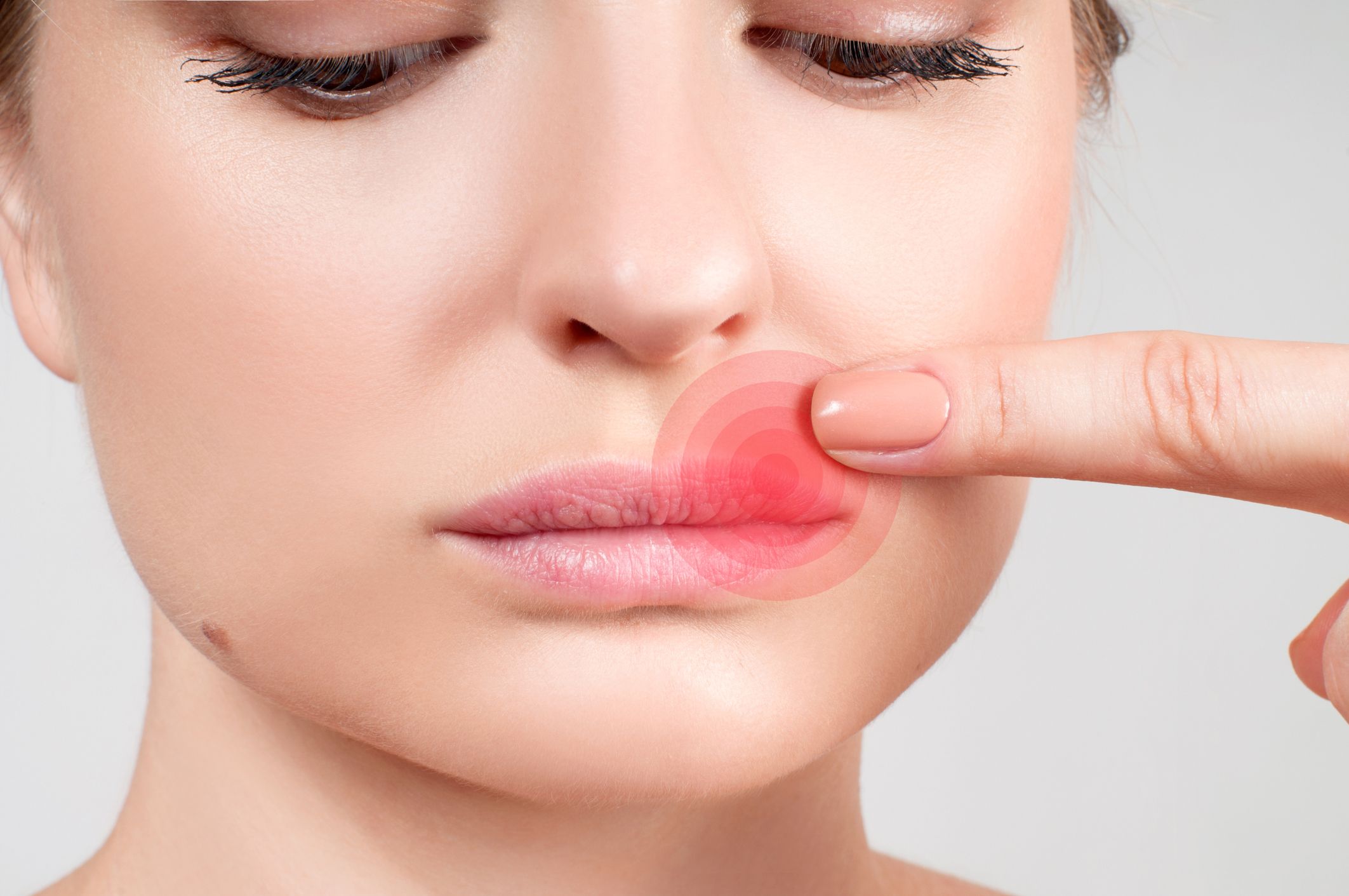 how to tell the difference between chapped lips and herpes