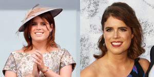 What Is Scoliosis? Princess Eugenie Shows Off Surgery Scar In Wedding Dress