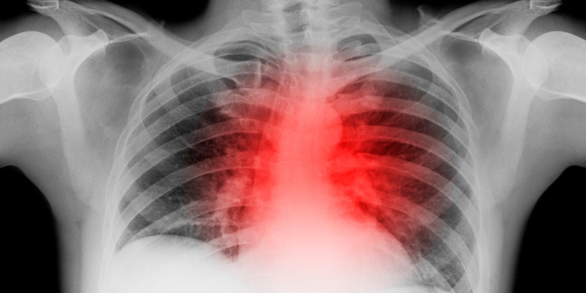 10 Signs of Heart Failure You Should Never Ignore, According to Doctors