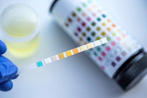 What Does the Color of My Pee Mean? 7 Urine Colors, Explained