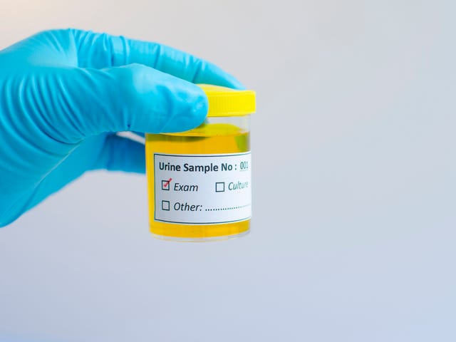Recurrent Uti Causes Treatment And Prevention