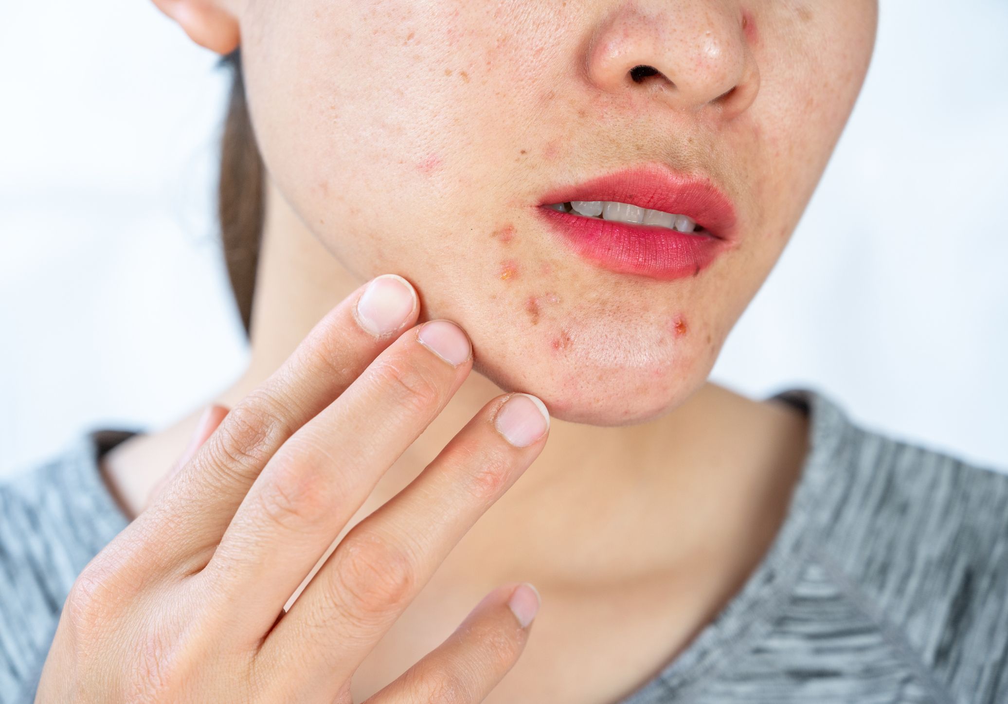 Red spots skin: causes, and when to worry