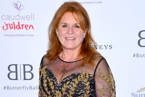 Sarah Ferguson, Sarah Ferguson retoques estéticos, Sarah Ferguson operaciones estéticas