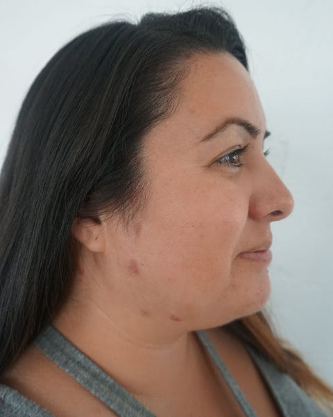 Dominique Lerma scar makeup tutorial before