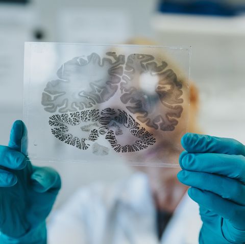 scientist holding human brain microscope slide while standing at laboratory