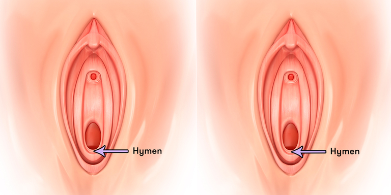 6 Things You Never Knew About Your Hymen-4034