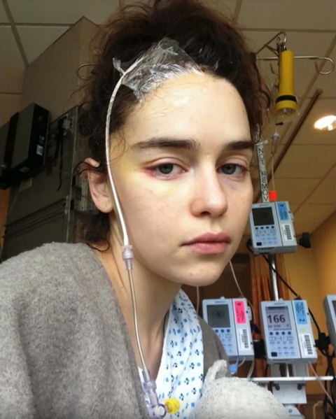Emilia Clarke Shares Rare Photos From Brain Surgery After Aneurysms