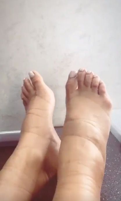 Pregnant Shay Mitchell Shares Photo Of Severely Swollen Feet