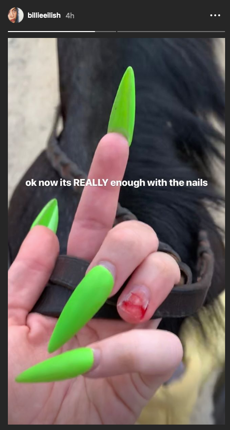 Billie Eilish shares picture of her broken her nail Billie Eilish shares picture of her broken her nail