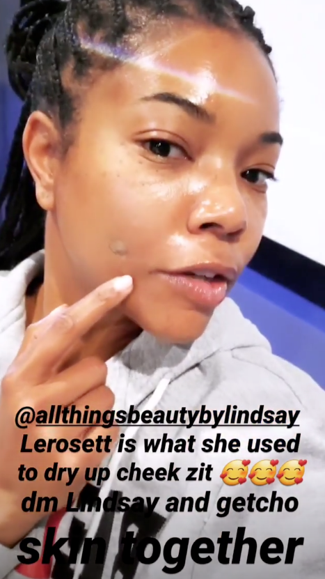 Gabrielle Union Shares Her Go-To Acne Spot Treatment On Instagram