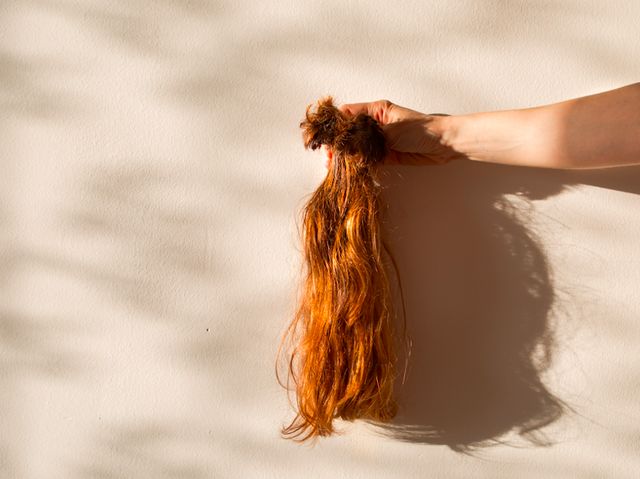 Female Hair Loss - Six Women On What Causes Hair Loss And Their Experience