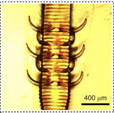 microscopic image of micro needle
