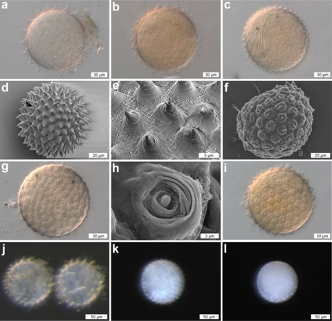 various dactylobiotus ovimutans eggs are shown, each displaying its own custom morphology
