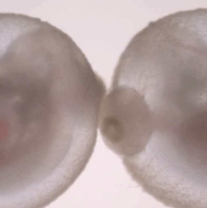 Scientists Grew a Mouse Embryo Outside the Womb. Are Humans Next?