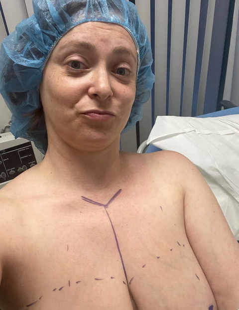 Rachel Bloom Shared Deeply Candid Before and After Pictures from Her