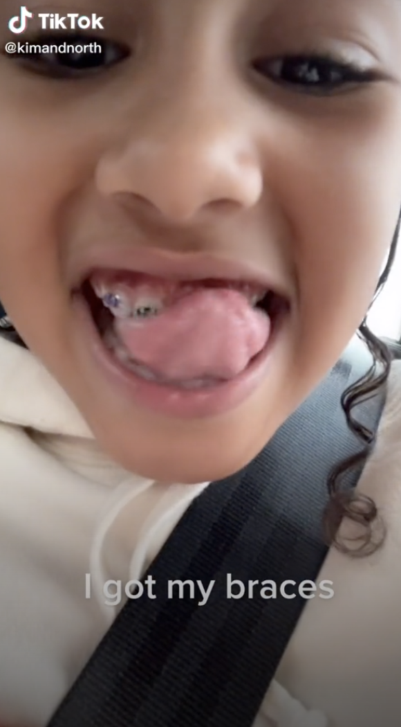 black tongue nadir 320 black tongue nadir 320