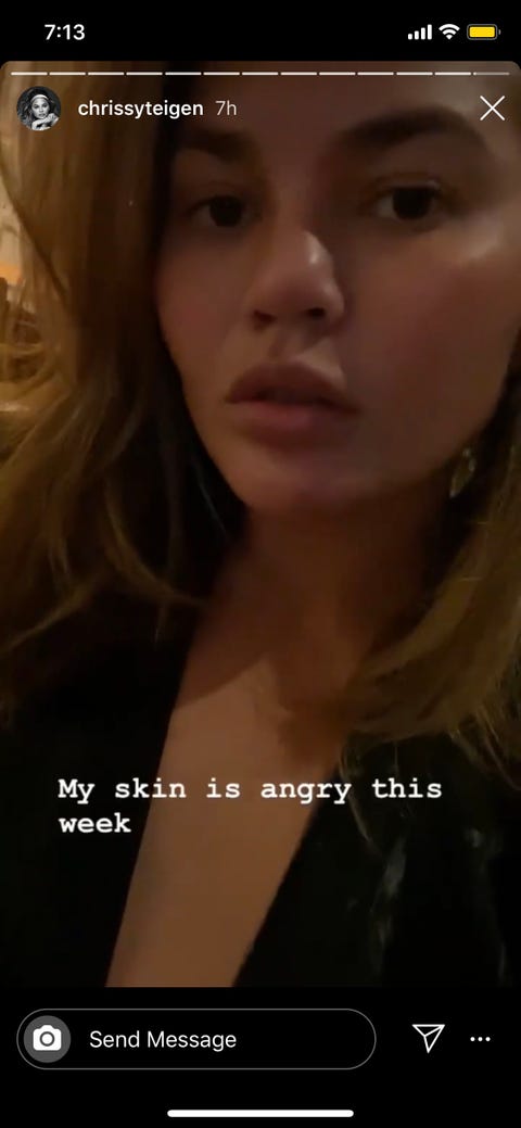 Chrissy Teigen S Major New Haircut And Color Looks Incredible