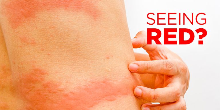 Whats That Rash On Your Body Womens Health