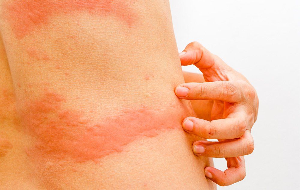 skin rashes that itch all over body