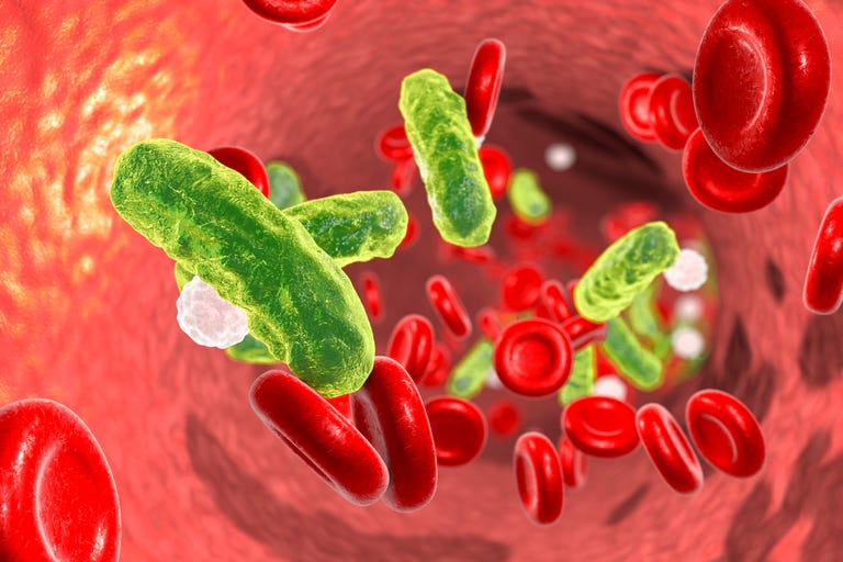 Sepsis Symptoms, Treatments & Causes - What Is Sepsis?