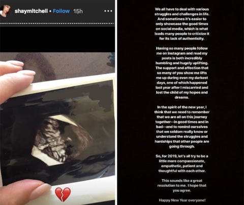 Shay Mitchell reveals abortion Shay Mitchell reveals abortion