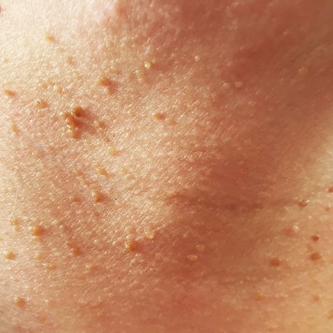 Brown, Skin, Peach, Photography, Close-up, Freckle, Scar, Flesh, 