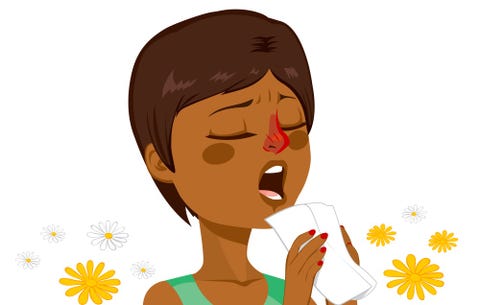 Sinus problems Sinus problems